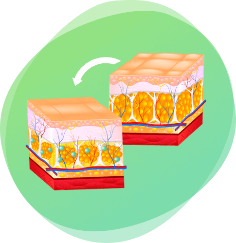 Zsírégetési folyamat